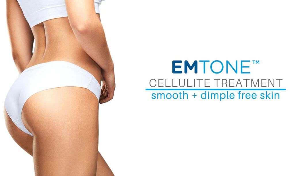 Emtone Treatable Areas​