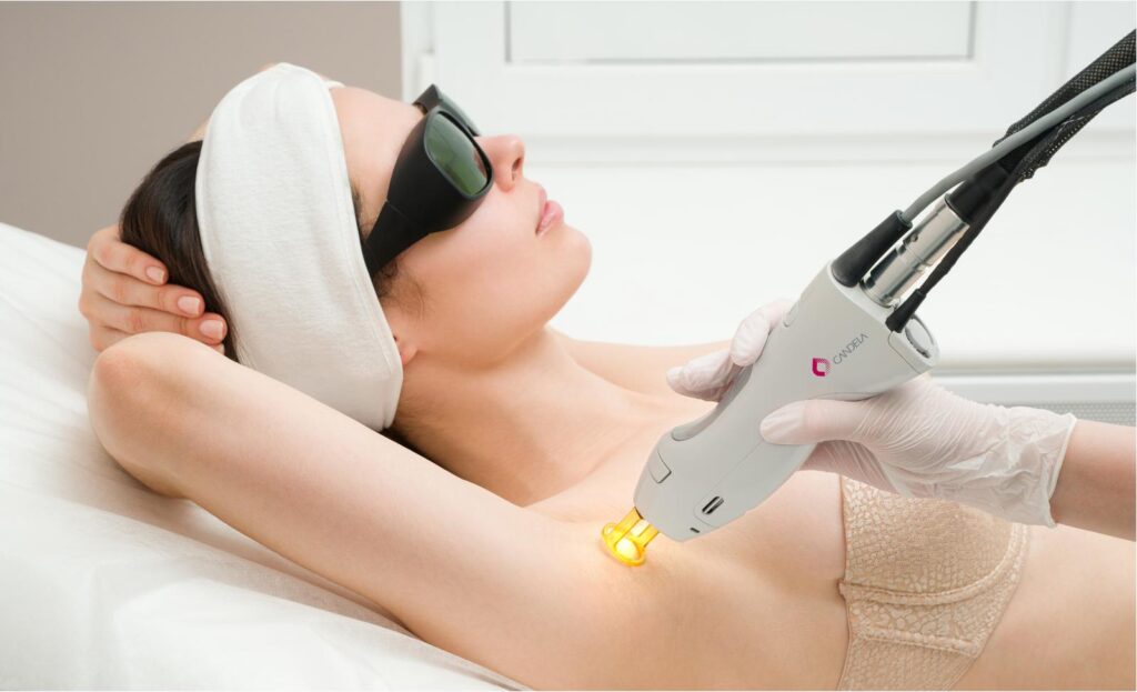 GentleMax Pro Plus Laser Hair Removal | Wings Wellness Spa